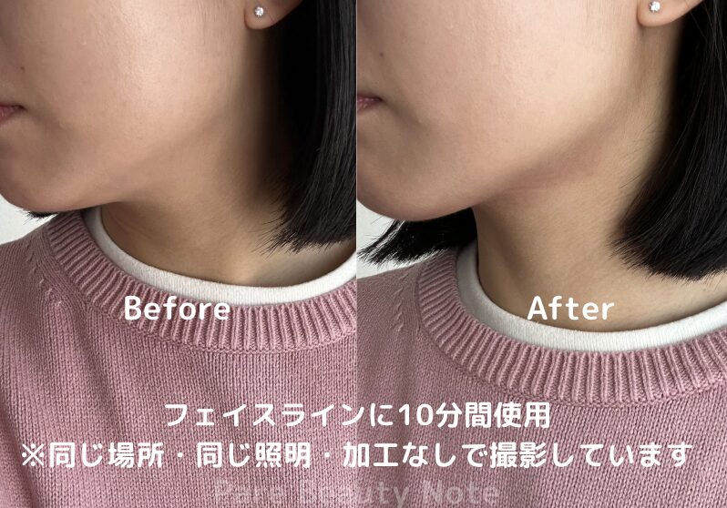 コアフィット　フェイスポインター　ビフォーアフター　フェイスライン