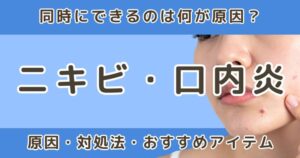 ニキビと口内炎が同時にできるのはなぜ?考えられる原因と対処法